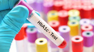 ارتباط بين HbA1C  و ميزان متوسط گلوكز خون 