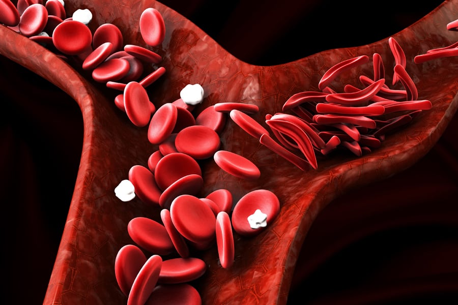 آیا کم‌خونی می‌تواند نشانه سرطان باشد؟